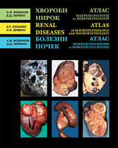 Хвороби нирок. Атлас макропатології та мікропатології - фото обкладинки книги