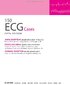 150 випадків ЕКГ: 5-е видання - фото 3